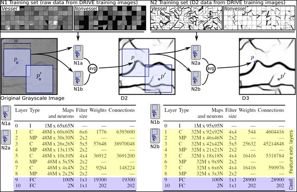 Blood vessel segmentation in retinal images