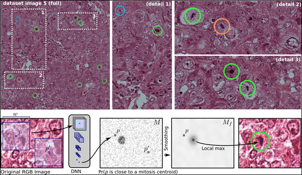 Mitosis detection in breast cancer histology images