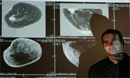 Medical Imaging