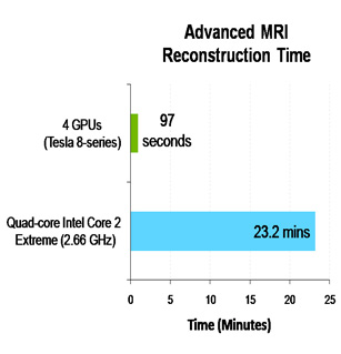 MRI Chart