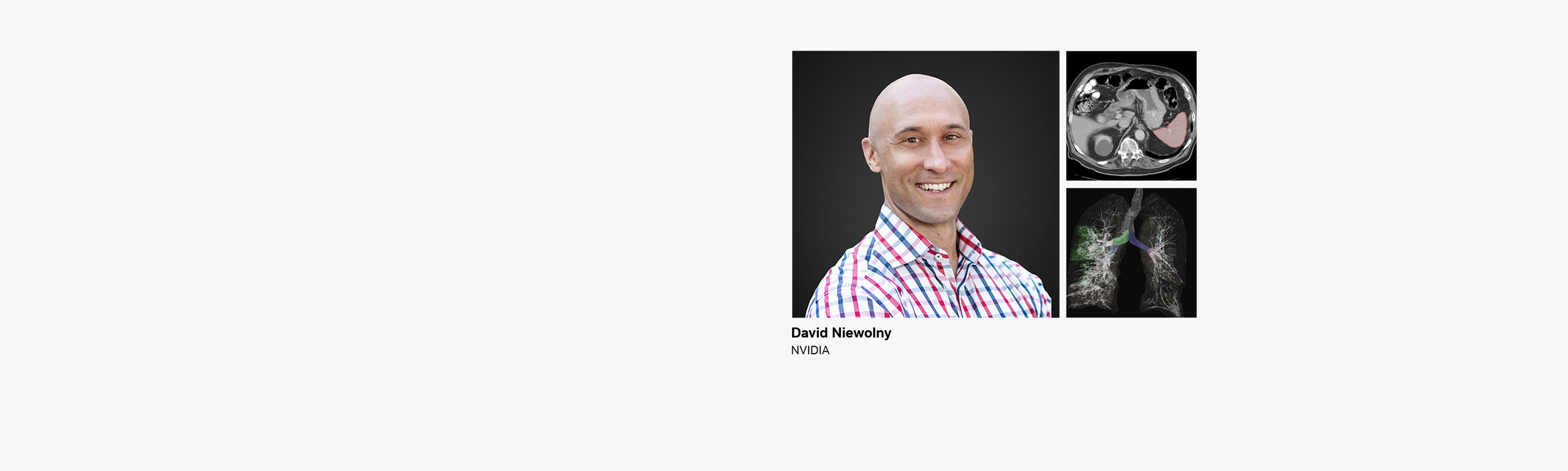  Discover the Latest AI Innovations for Medical Imaging