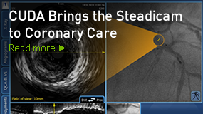 CUDA Brings the Steadicam to Coronary Care