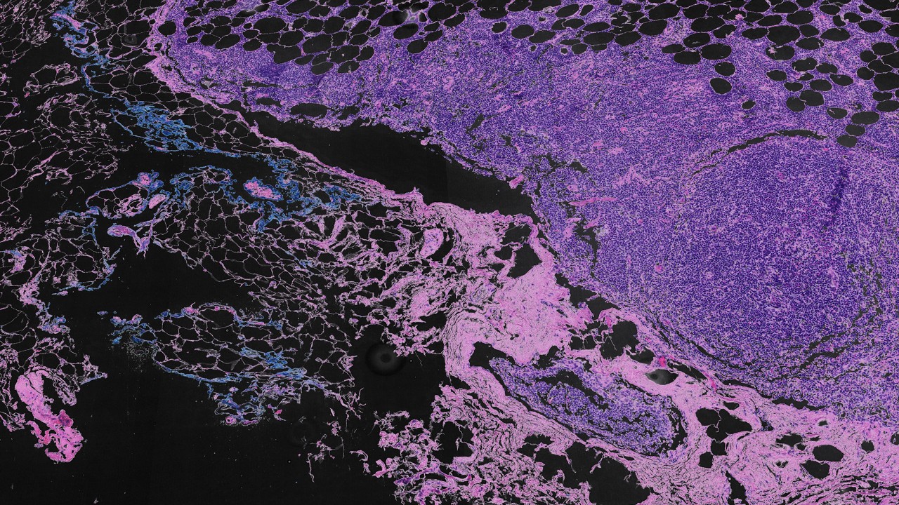 Une startup d'IA pour la santé optimise l'analyse des cellules cancéreuses dans les salles d’opération