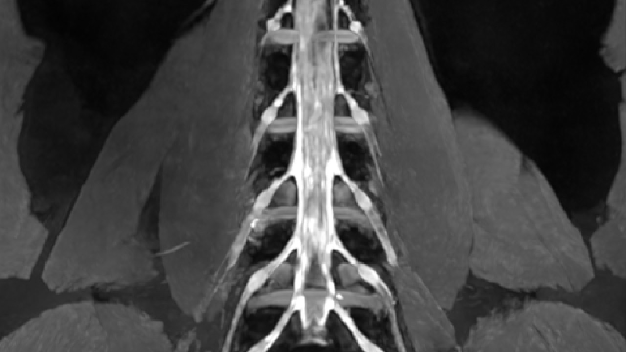  High-resolution lumbar plexus imaging