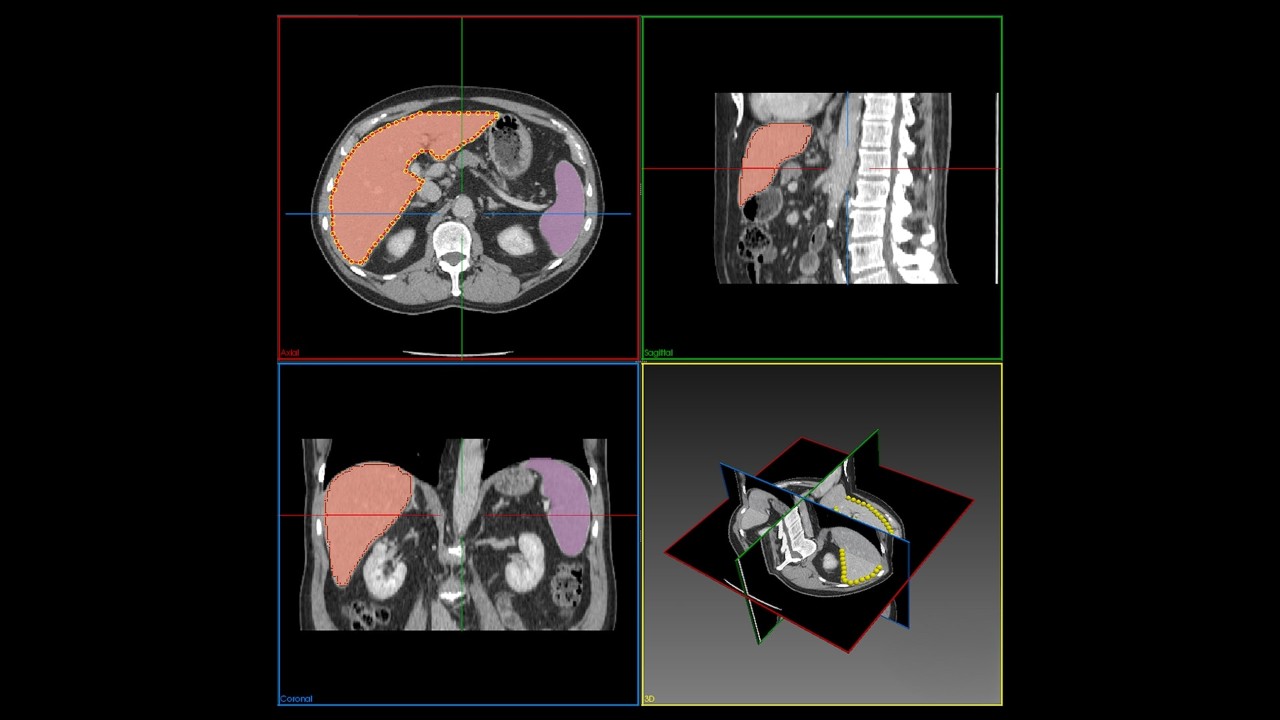 Medical images showing cross-section scans of various organs.