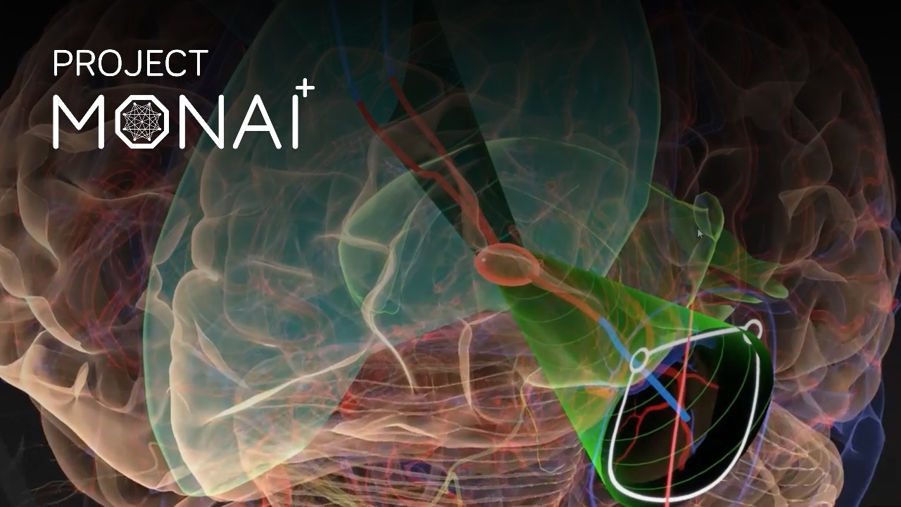 Develop Medical Imaging AI Applications With Open-Source Tools