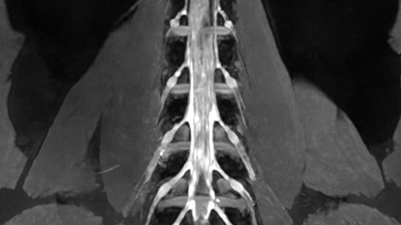 NVIDIA の AI で医用画像の再構築を高速化