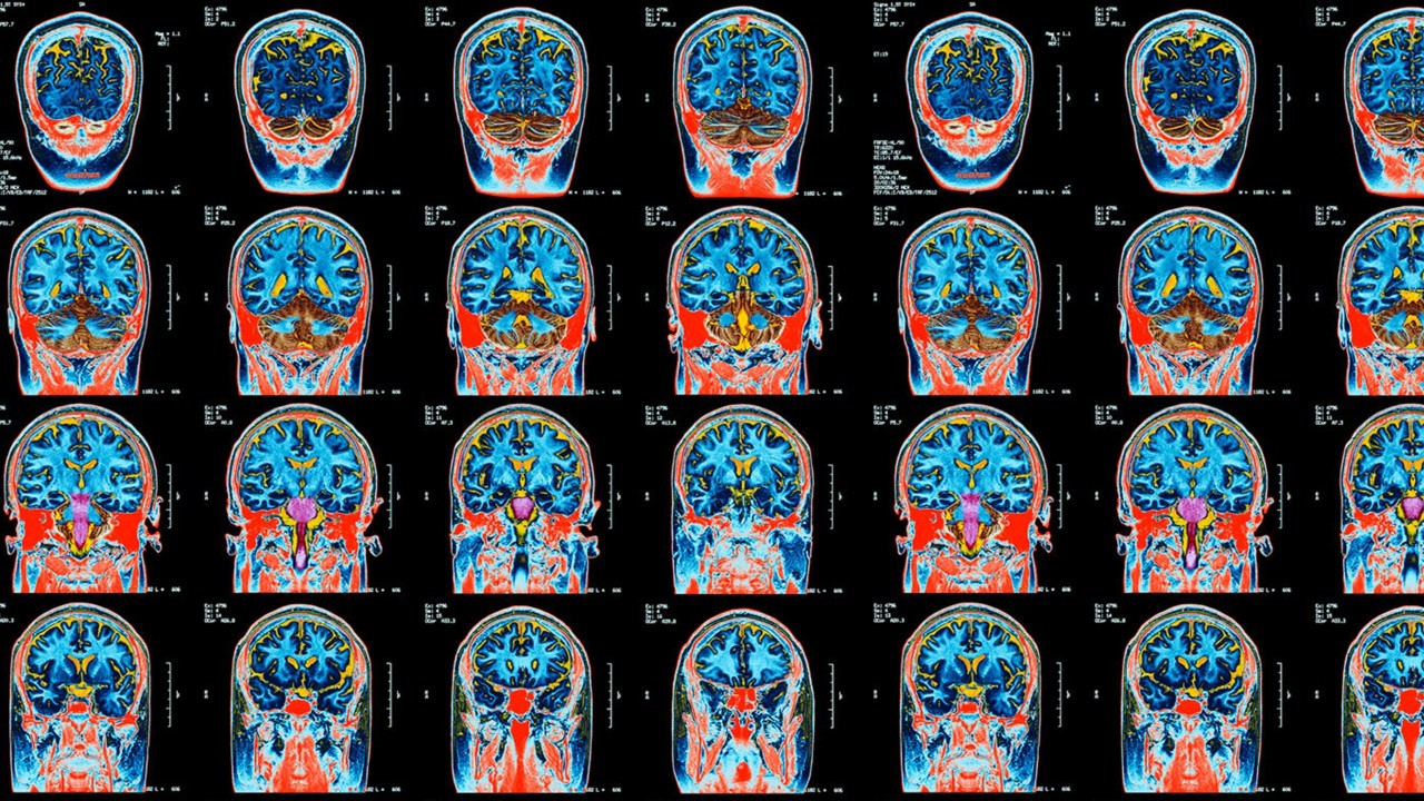 Image of multiple diacoms of the human brain.