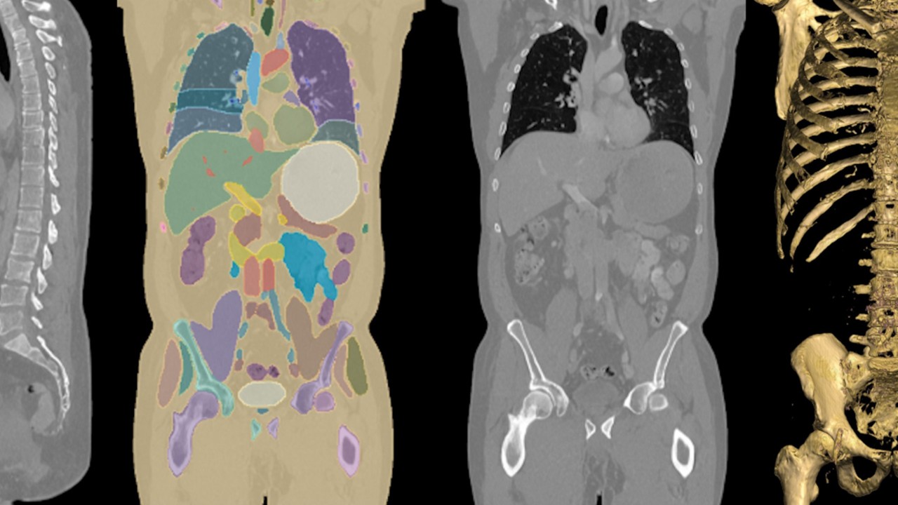 오픈 소스 도구 및 고급 모델로 의료 AI 훈련 최적화