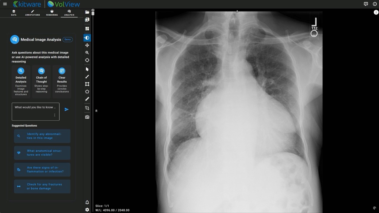 방사선 에이전트를 위한 의료 이미지 분석과 대화형 AI를 결합