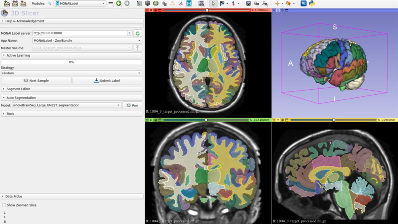 AI 기반 분석 및 추론으로 의료 이미징 혁신