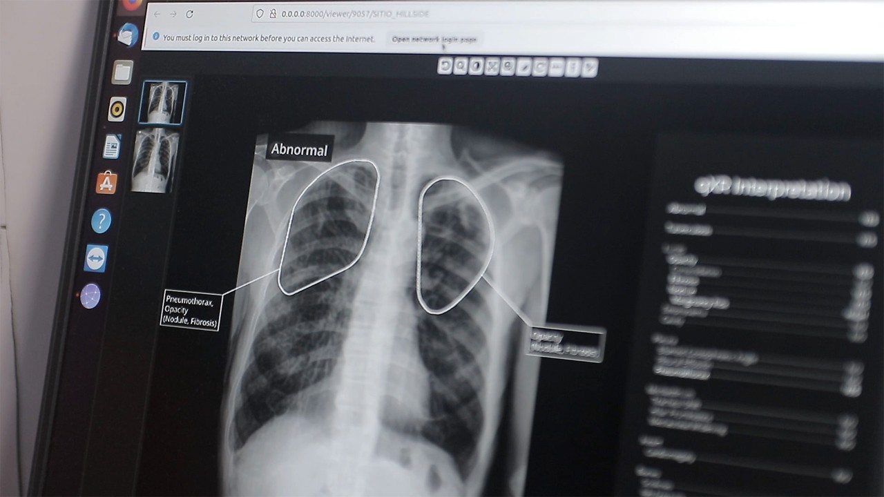 Qure healthcare AI meet the startup video