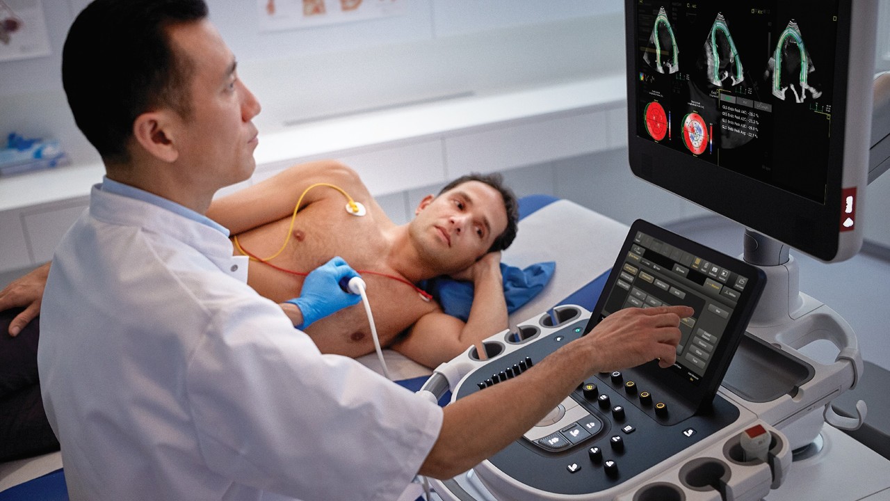 Epiq CVx Ultrasound system in a diagnostic clinical setting