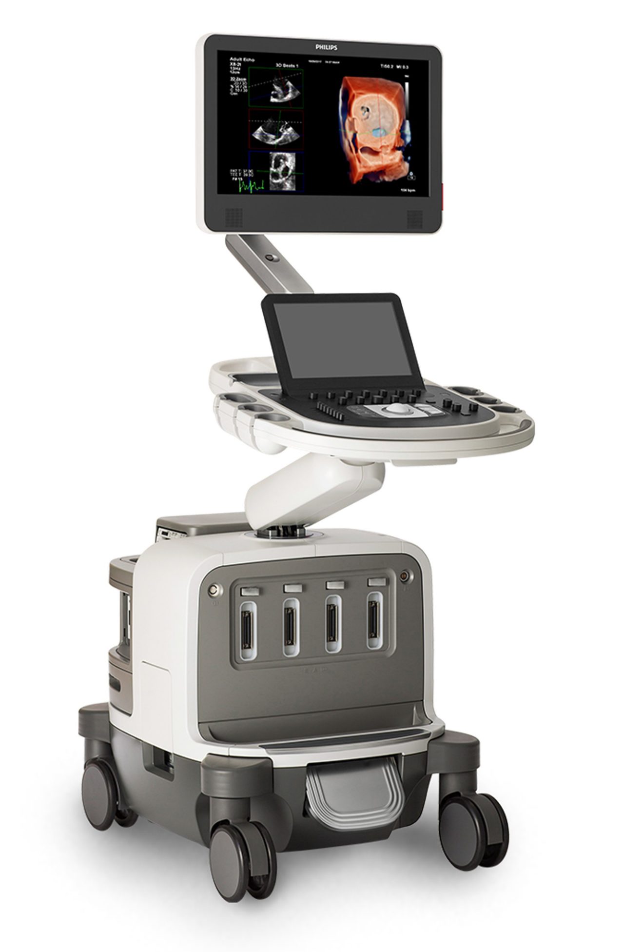 Epiq CVx Ultrasound system, utilizing GPU-powered nSight Plus image formation